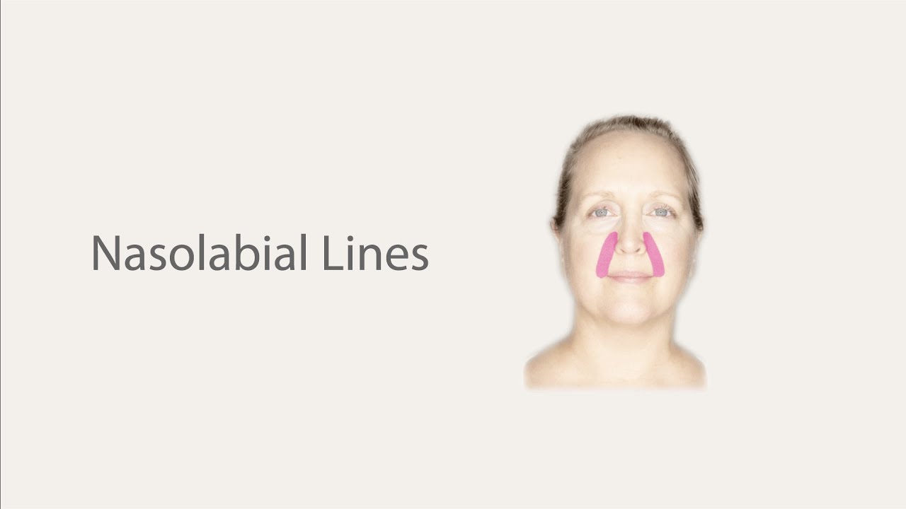 Face Taping tutorial for dealing with Nasolabial Lines [laugh or smile lines]