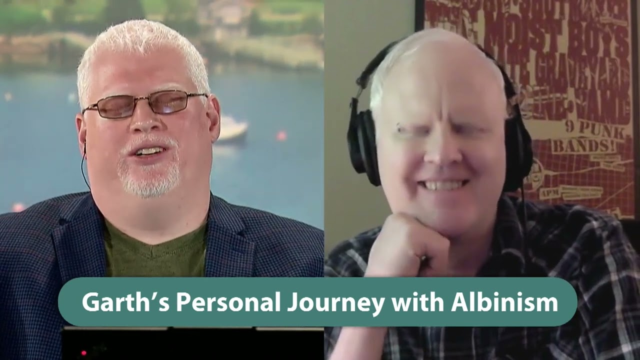 NOW with Dave Brown Highlight: International Albinism Awareness Day with Garth Mullins