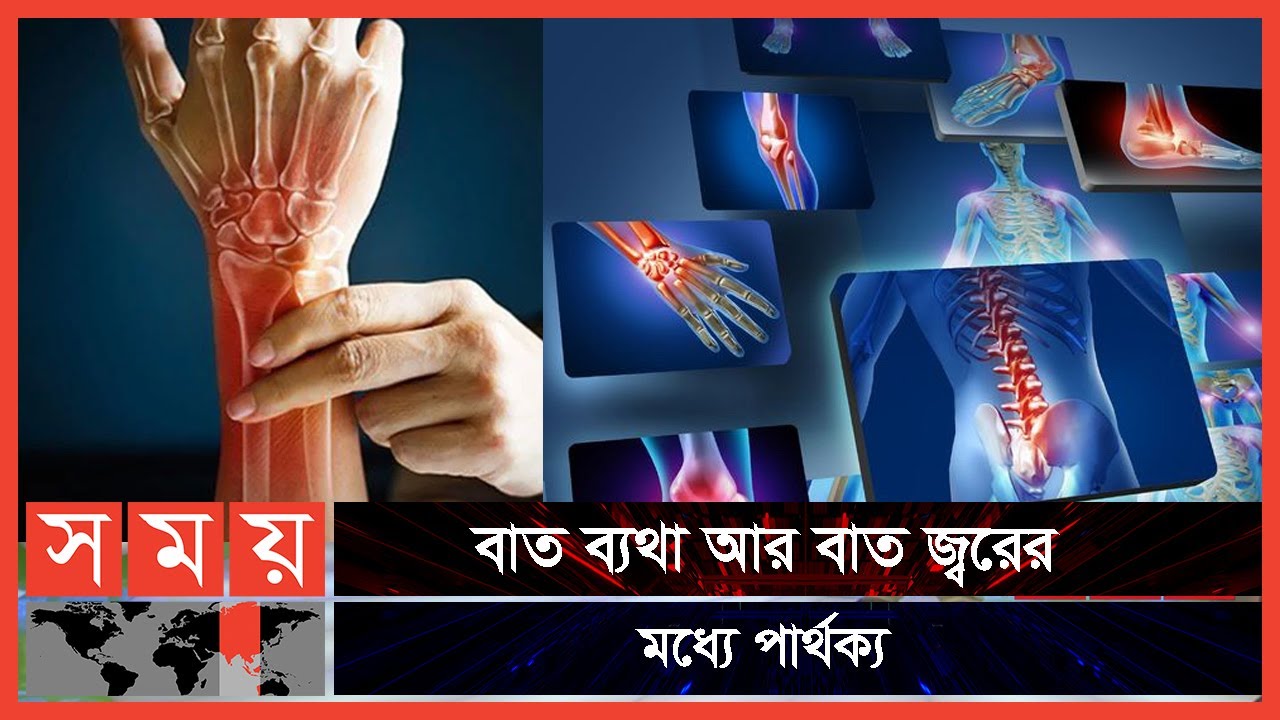 সামলে রাখুন বাতের ব্যথা | বদ্যি বাড়ি | Boddi Bari | Rheumatic fever | Somoy TV