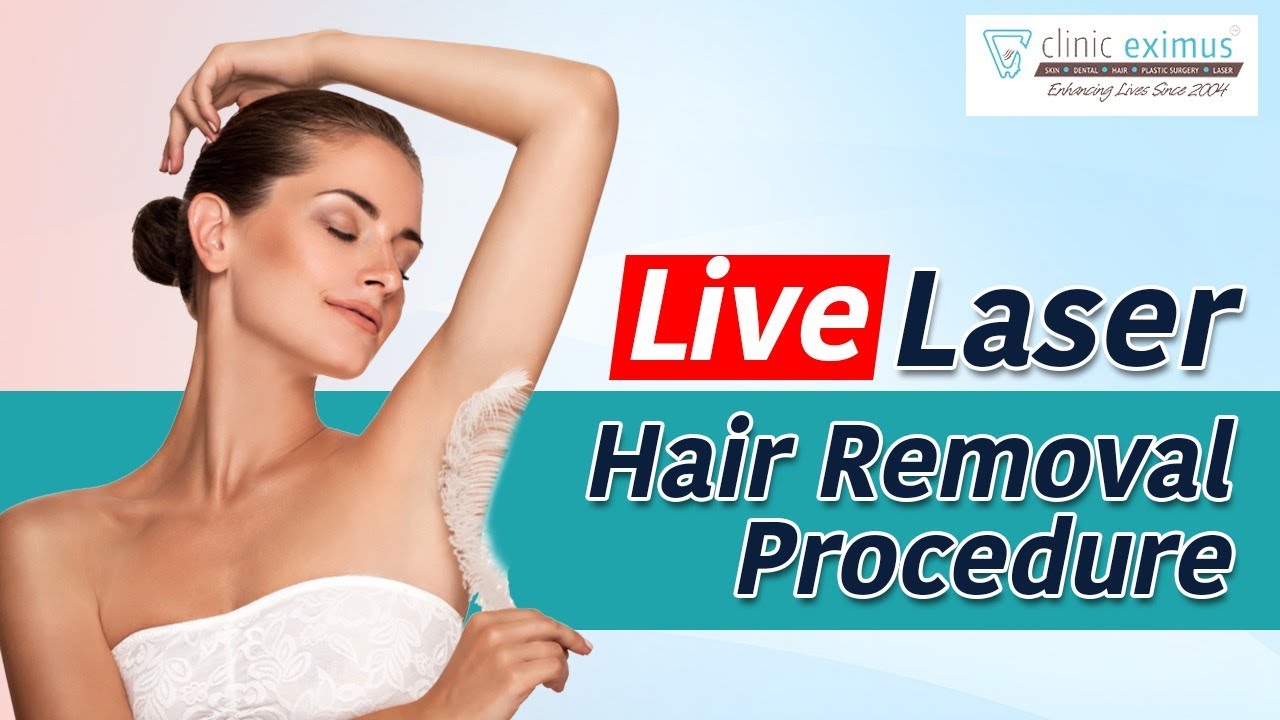 🔴 Live Laser Hair Removal Procedure | Laser Hair Reduction Procedure Explained | Clinic Eximus