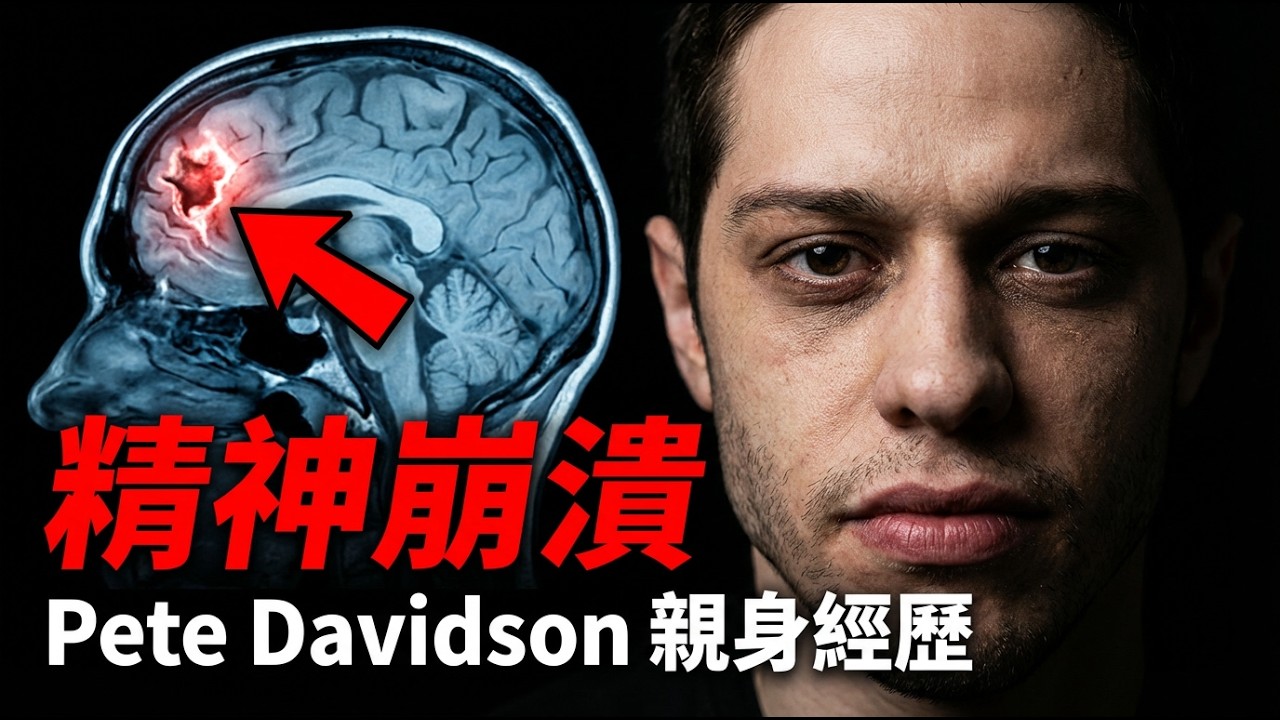 Pete Davidson聽見鬼聲的警訊：90天戒掉，奪回你的大腦主權