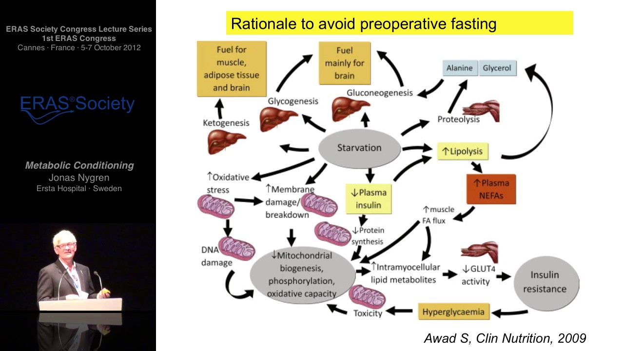 Metabolic Conditioning - Enhanced Recovery after Surgery (ERAS®)