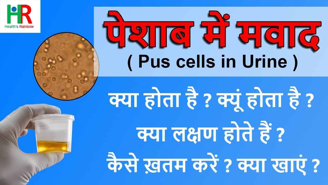 Pus Cells in urine in Hindi | What are pus cells? | What is the normal range of pus cells?