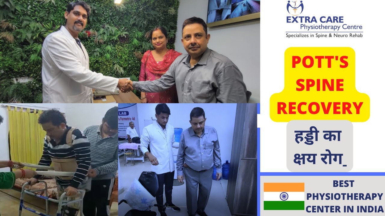 Pott's Spine Physiotherapy Treatment | Best Recovery for Pott's Spine in INDIA | TB of Spine