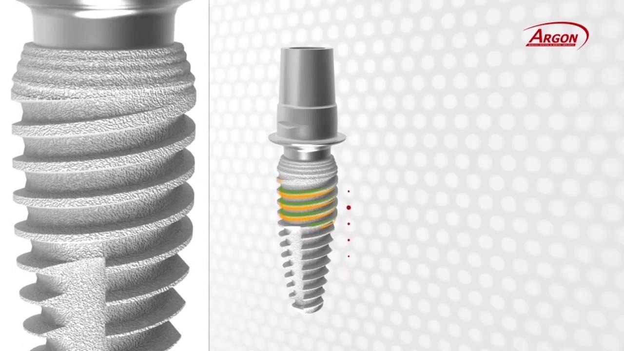 Argon Rapid & Sure Implant Features & Benefits Video