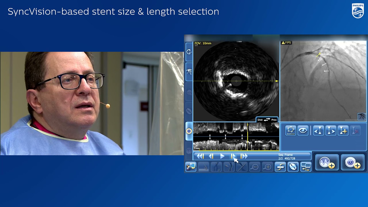 Bifurcation stenting
