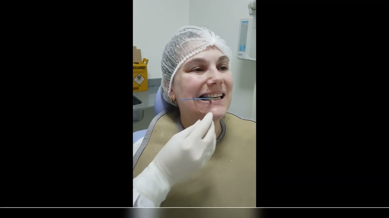 Técnica interproximal com posicionador e aleta - Radiologia I - Odontologia UFSM