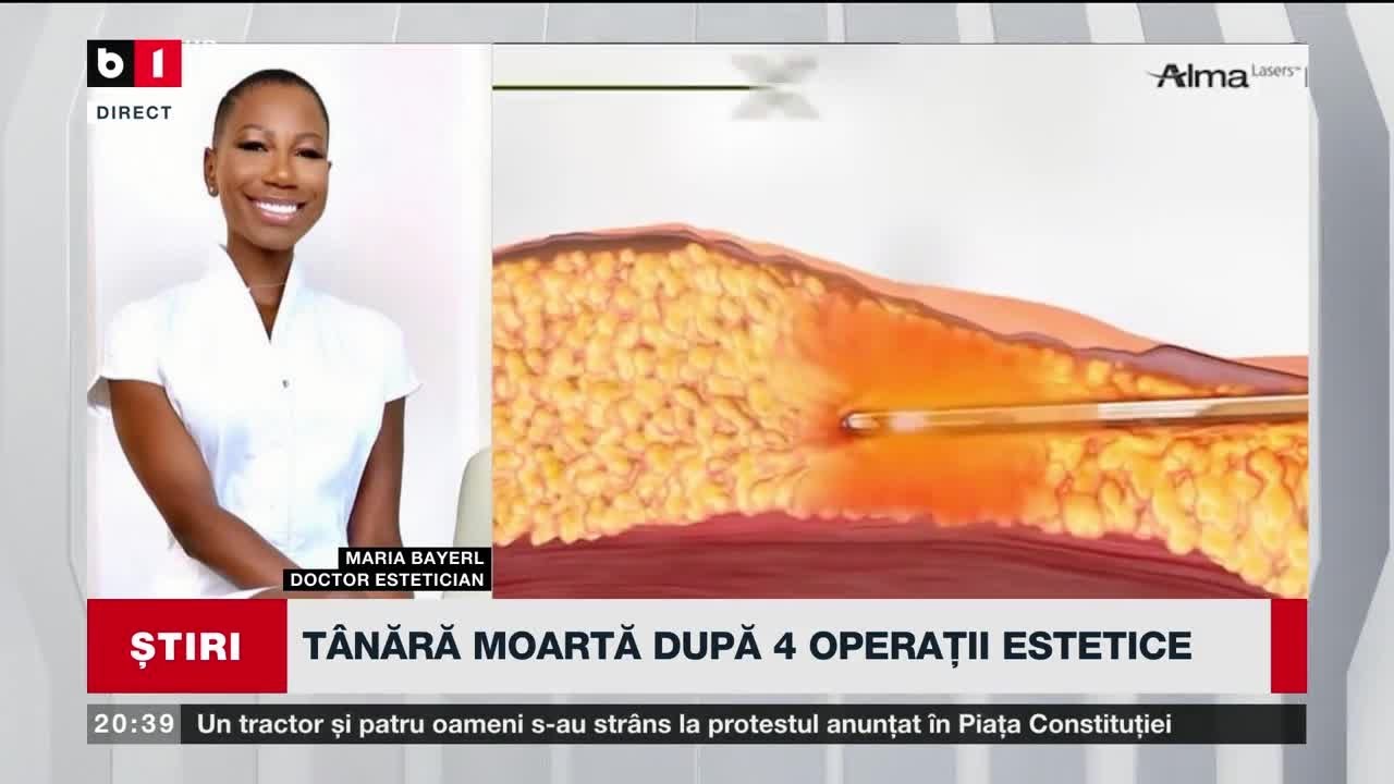 TÂNĂRĂ MOARTĂ DUPĂ 4 OPERAȚII ESTETICE. Știri B1TV_21 IAN. 2024