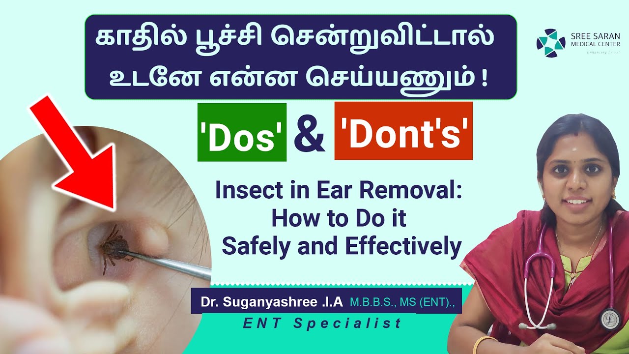 Insect in ear Removal Do's & Don'ts  | காதல் பூச்சி சென்று விட்டால் உடனே என்ன செய்ய வேண்டும்