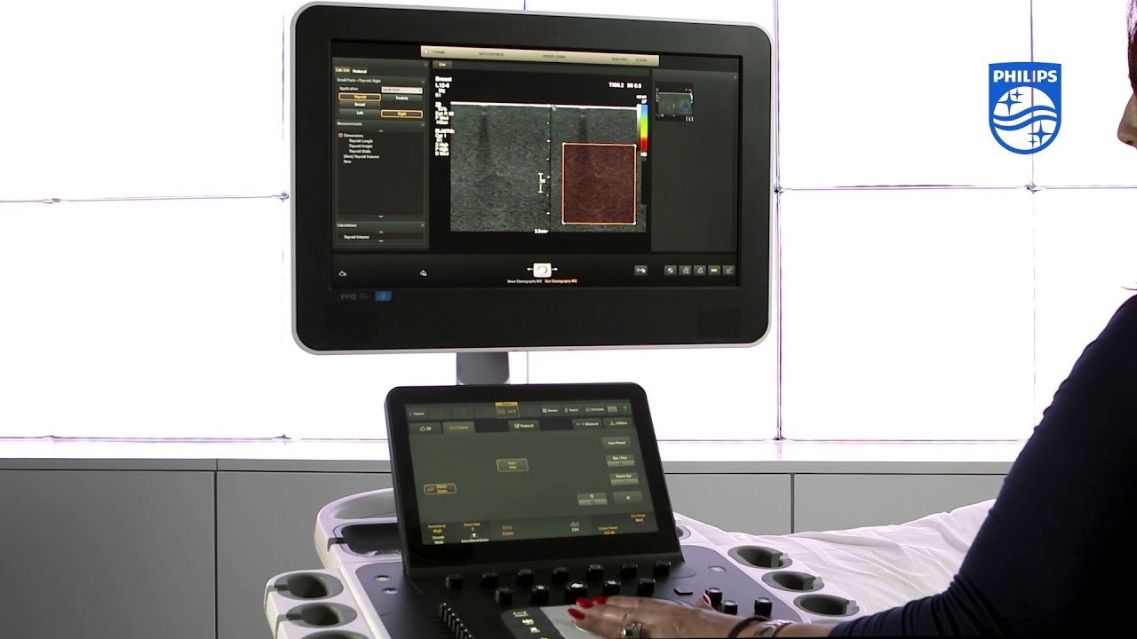 How To Perform Strain Elastography on Philips EPIQ Ultrasound Systemsvvv