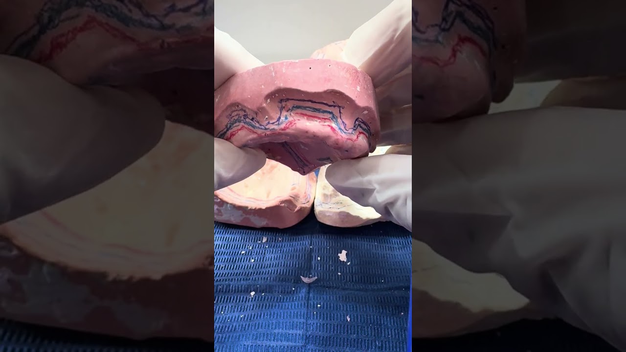 Líneas en modelos reales superiores de acuerdo a la técnica para elaboración de cucharillas