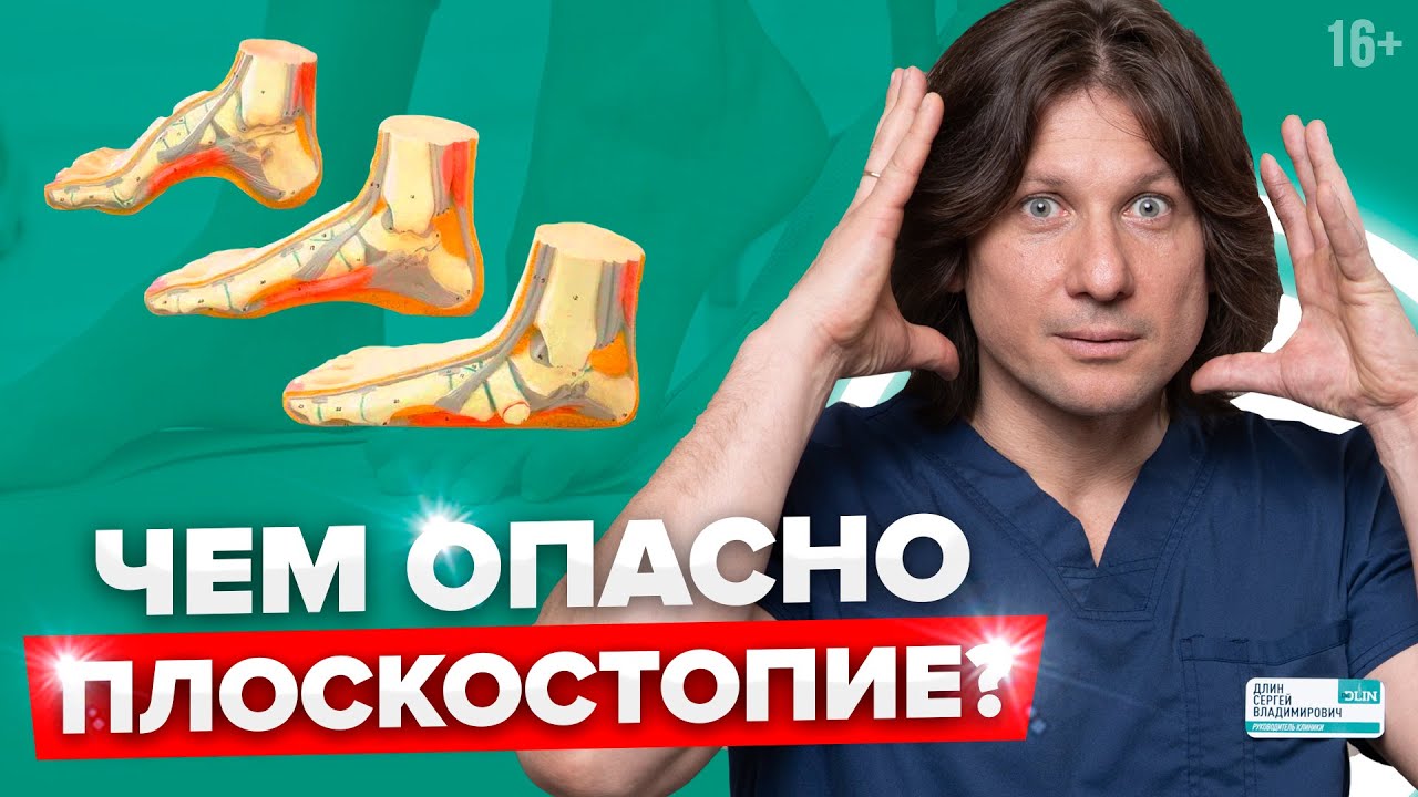 Страшные последствия плоскостопия! Как определить плоскостопие в домашних условиях?
