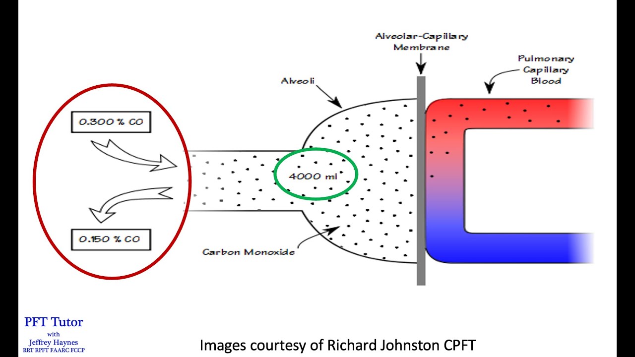 How to Interpret a Diffusing Capacity (DLCO) Test