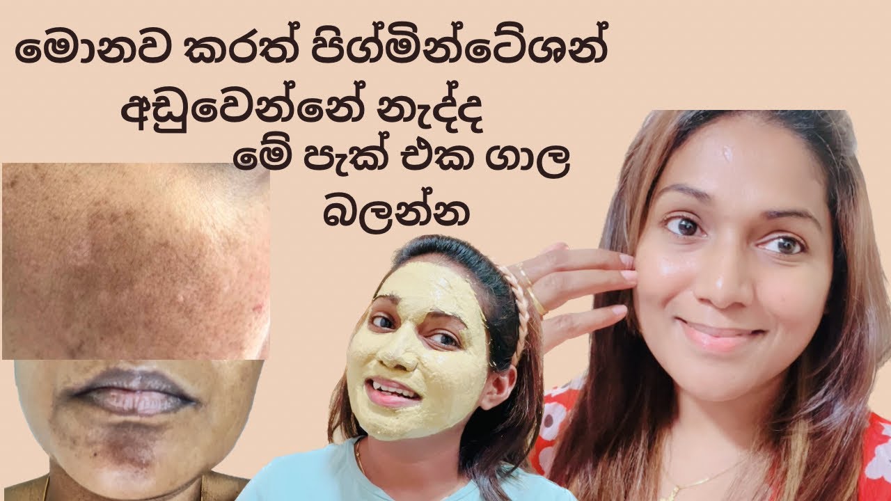 මුහුණේ කලු ලප කටවටේ කලු පැහැය,how to treat pigmentation,dark spot,black patches,melasma at home Diy