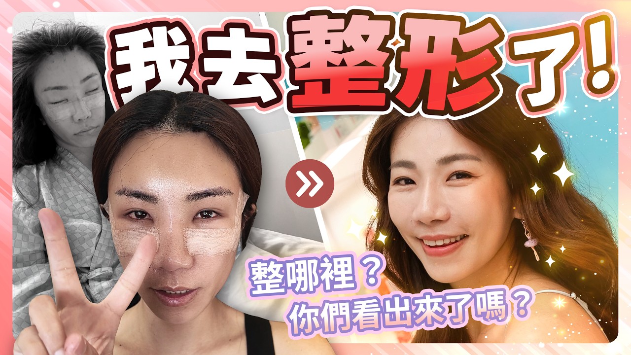 我去整形了!整哪裡?你們看出來了嗎?