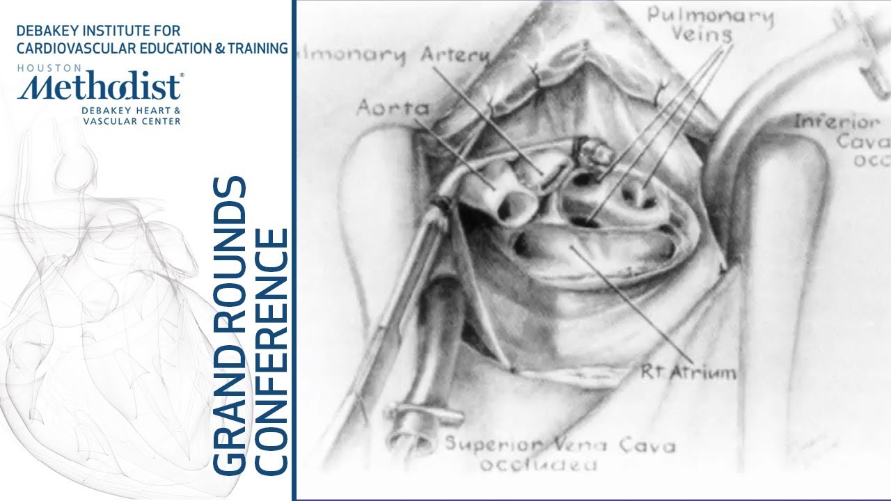 Heart Transplantation: What Have the Last 50 Years Taught Us? (David O. Taylor, MD) October 18, 2018