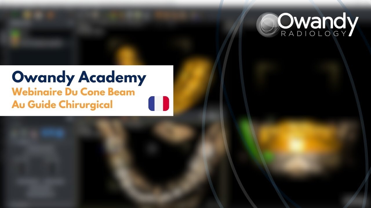 Webinaire Owandy (3D Training) Du Cone Beam Au Guide Chirurgical (version française)