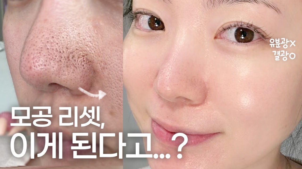 이벤트) 피지+모공 다 잡기? 홈케어로 진짜 됨! 💚라일리X성분에디터💚 마켓 공지! 2/3 OPEN