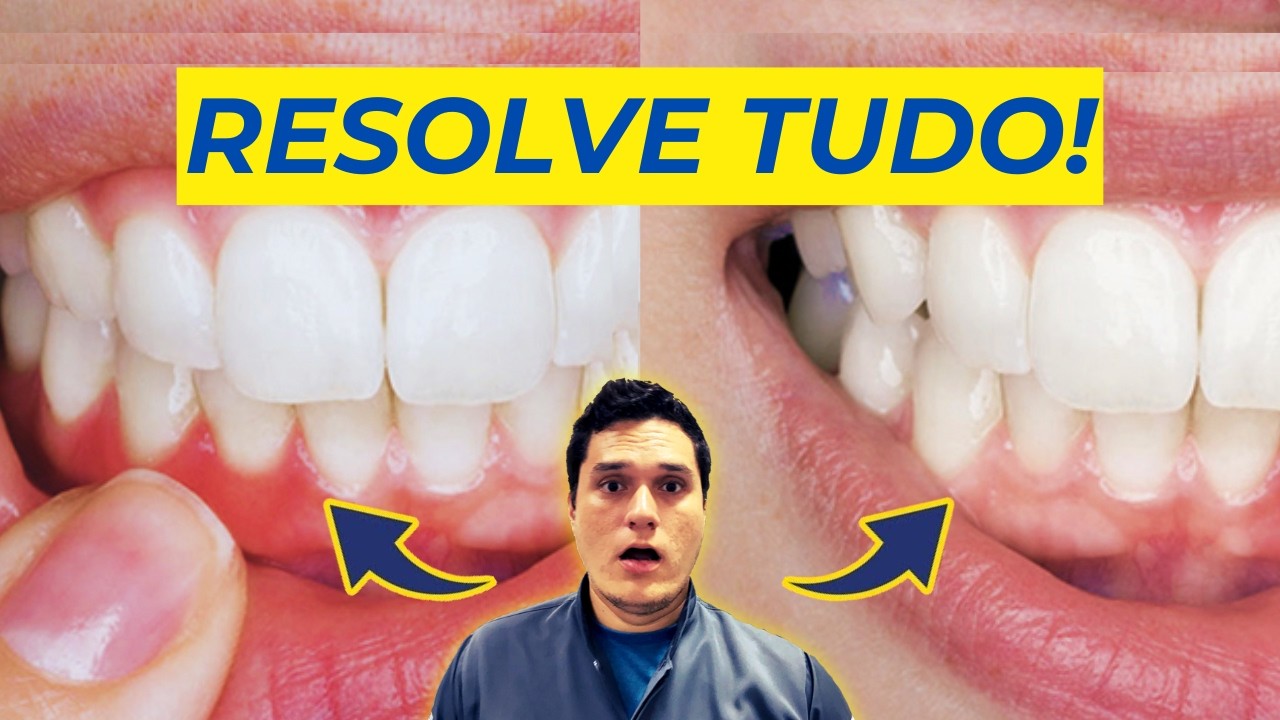 Gengiva inchada, o que pode ser? Como tratar?
