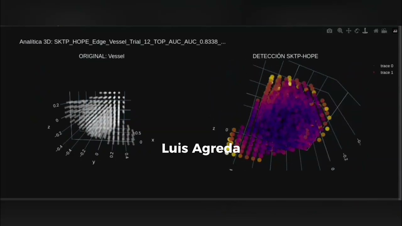 La Revolución del Computer Vision: TinyModels, Nuevas Neuronas, AGI y GreenAI #AGI #ai 