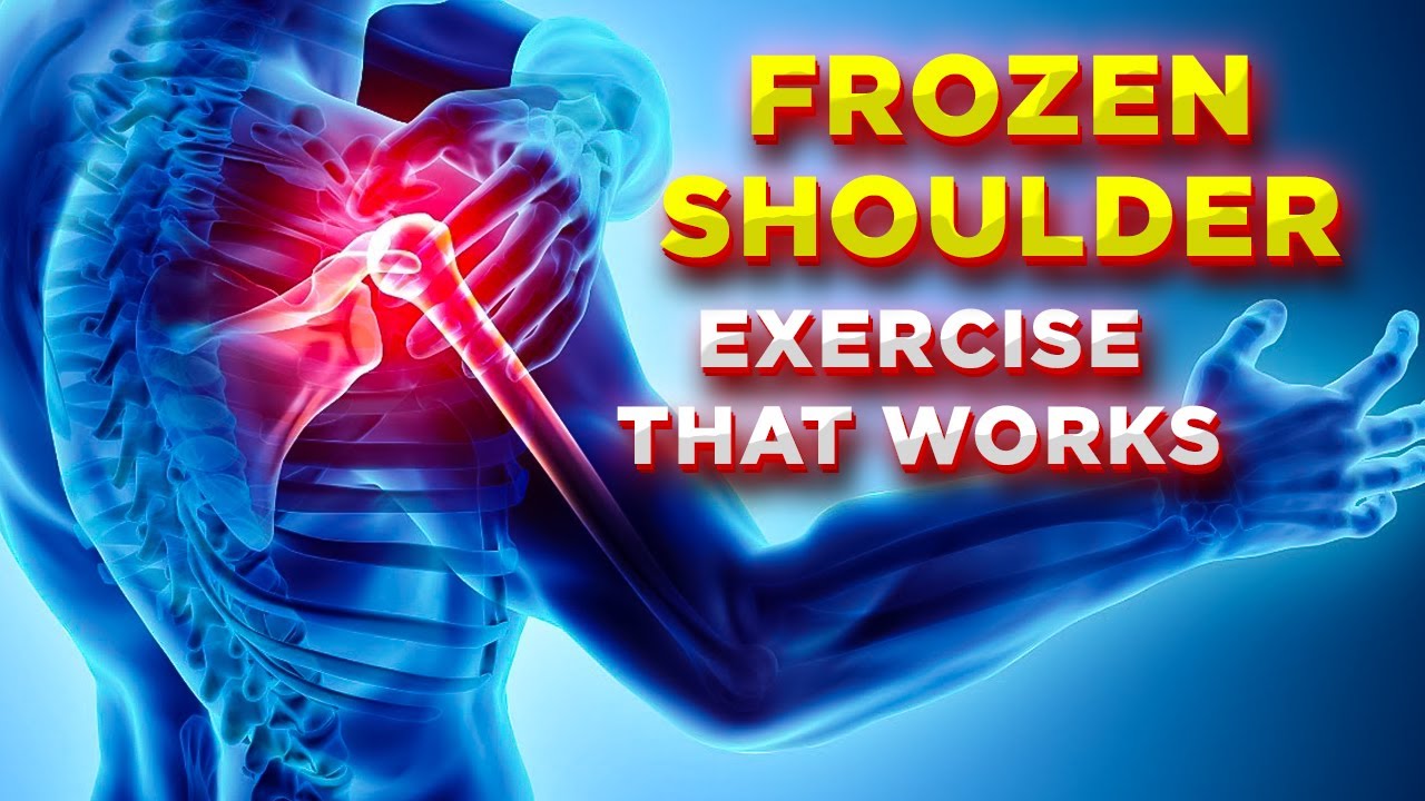 फ्रोजन शोल्डर का घरेलू इलाज, ये 9 असरदार एक्सरसाइसेस | Frozen Shoulder Treatment