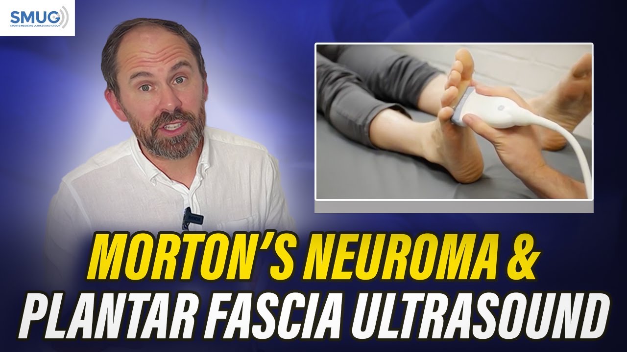 Morton’s Neuroma & Plantar Fascia Ultrasound | MSK Imaging Explained