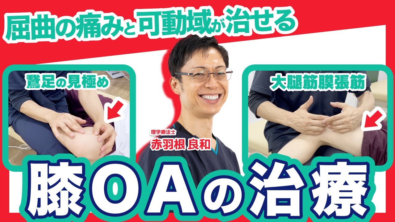 【有料級】膝OAの痛みと可動域の治療！【鵞足部・大腿筋膜張筋・膝蓋骨の引き下げ等】