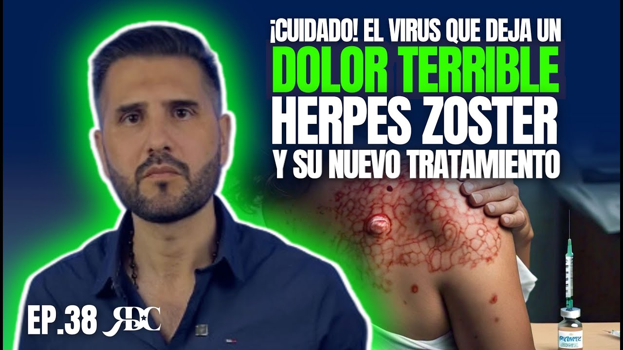 ¿SARPULLIDO DOLOROSO? Podría Ser HERPES ZÓSTER: Aprende a Detectarlo y Tratarlo I EP. 38