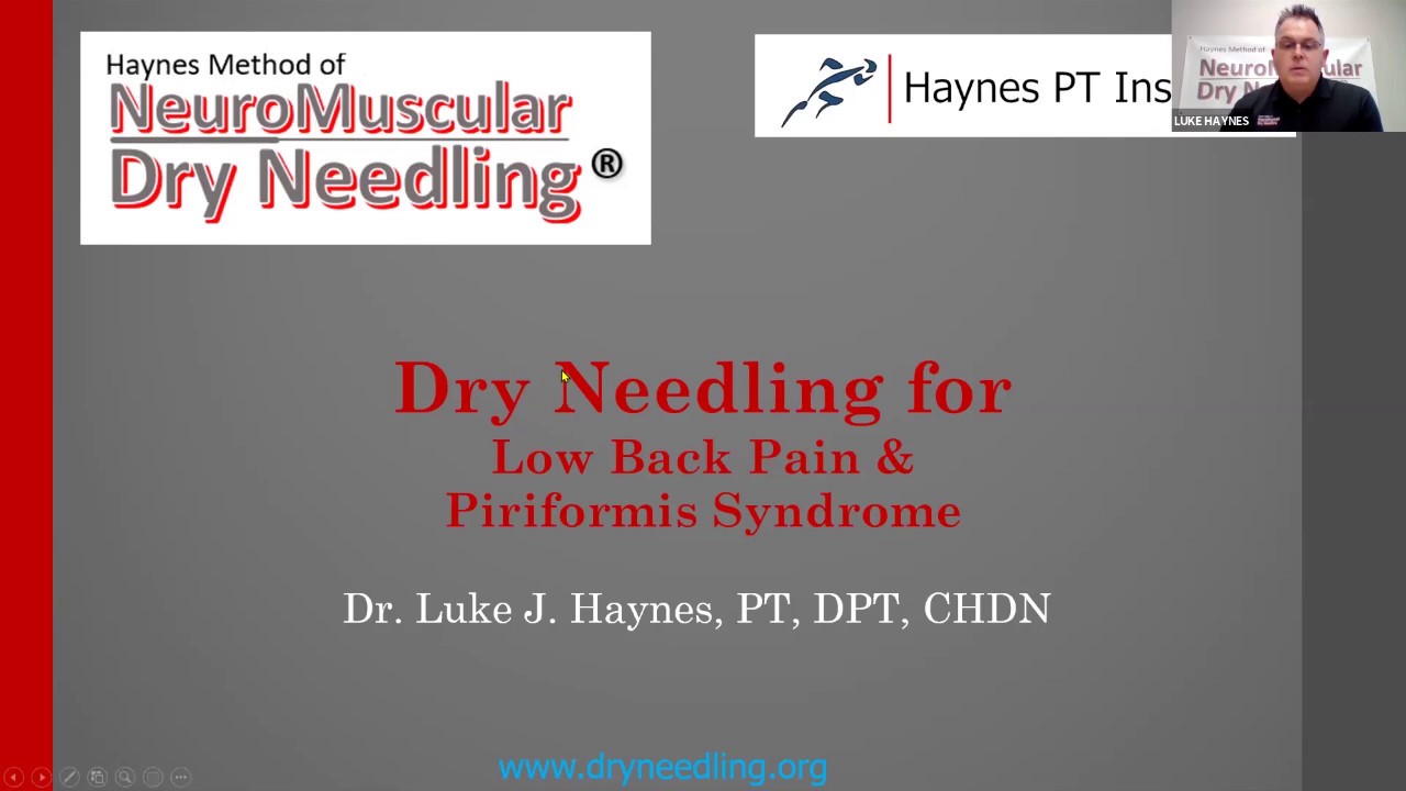 Dry Needling for Low Back Pain and Piriformis Syndrome Webinar