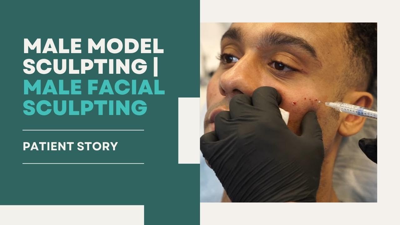 ⚒️ MALE MODEL SCULPTING | MALE FACIAL SCULPTING 💉 PATIENT STORY | Dr. Jason Emer