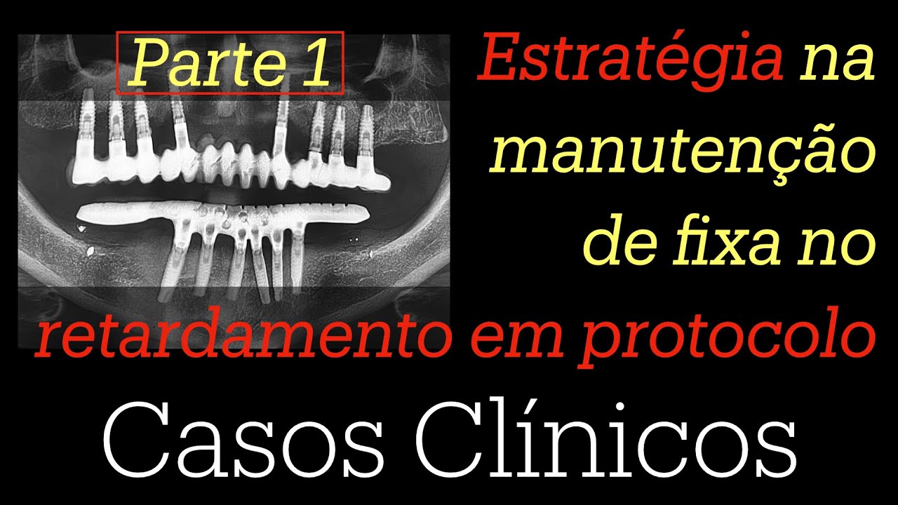 Parte 1. Estratégia na manutenção de fixa no RE-tratamento de protocolo.