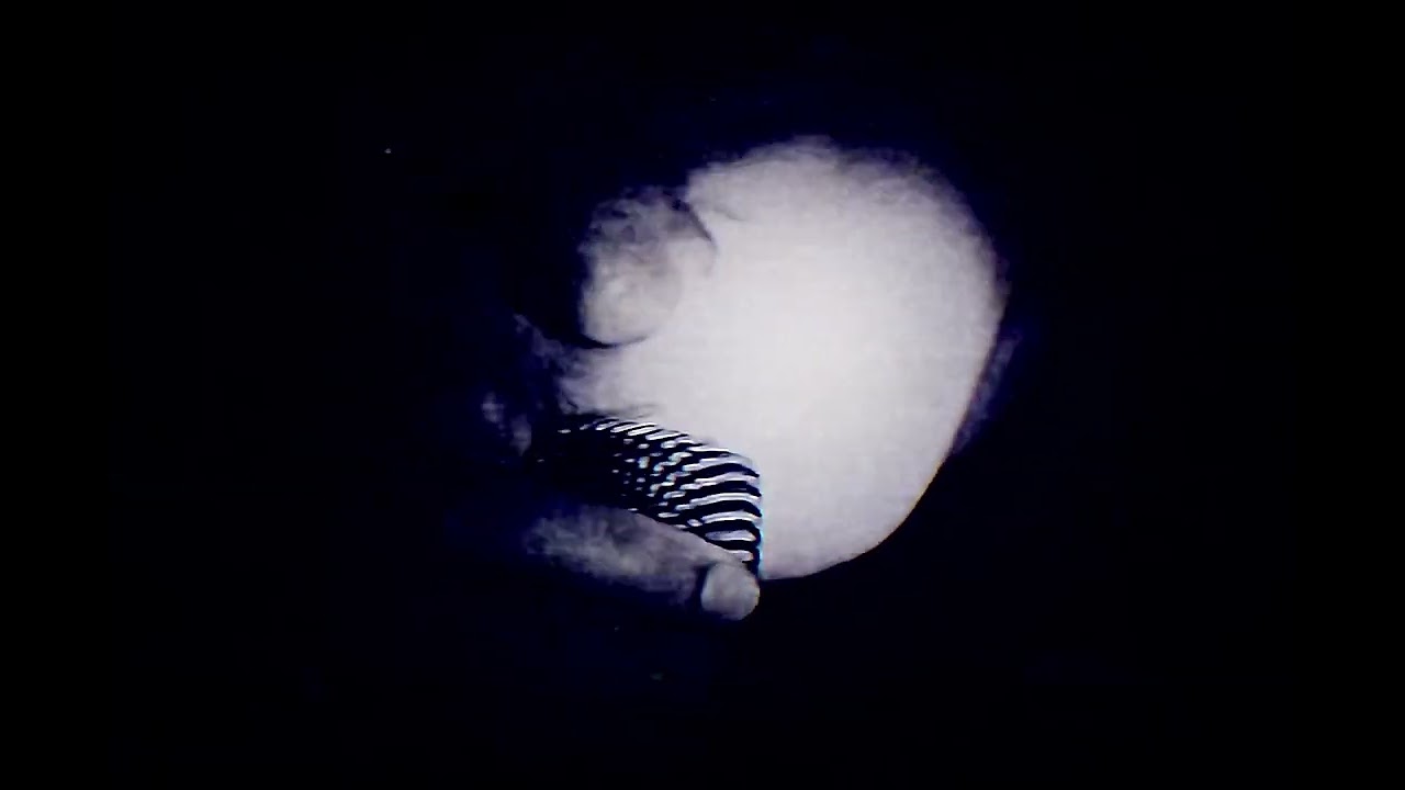 Prodigal - Forever//Forgot (Official Music Video)