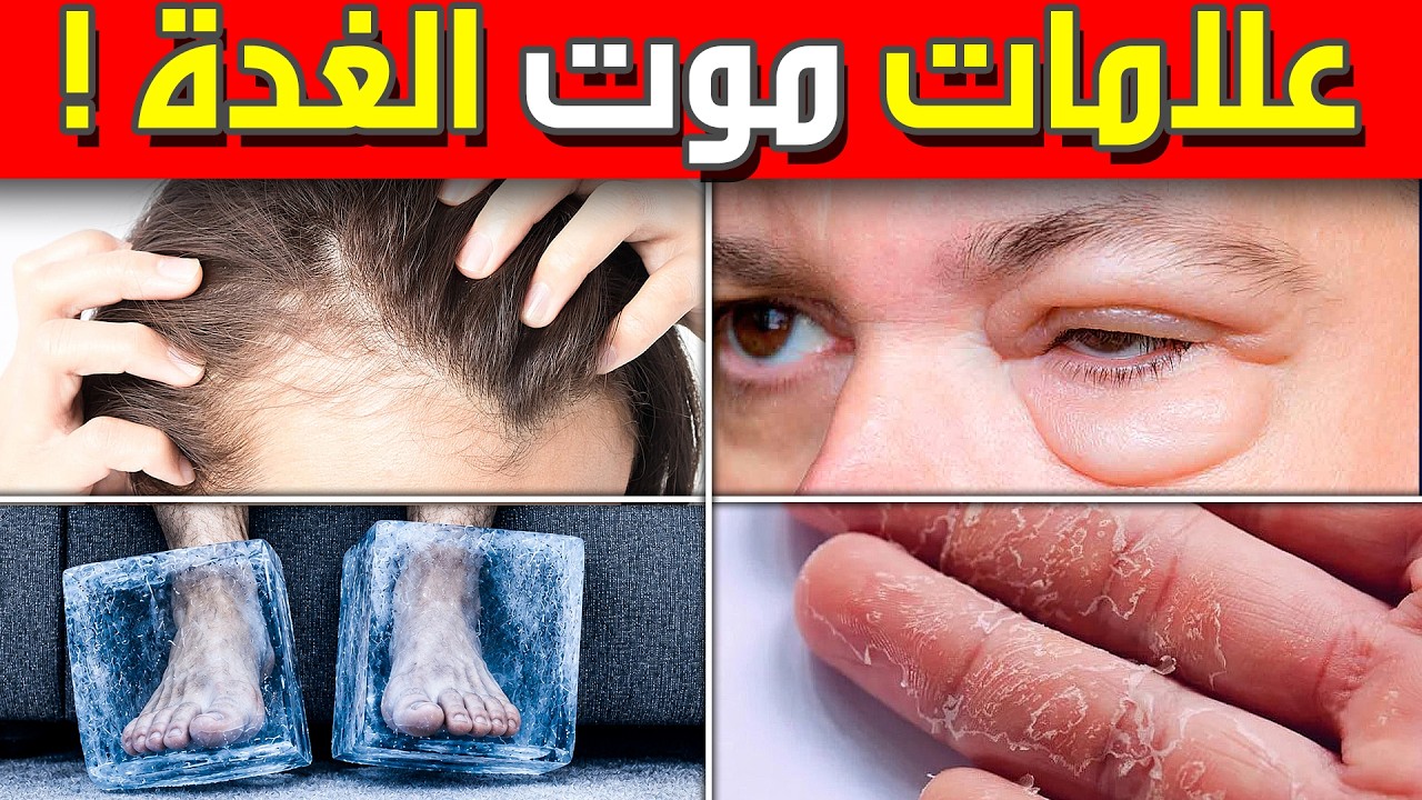 ‏10 علامات غريبة على قصور الغدة الدرقية (و أقوى علاج طبيعي!)