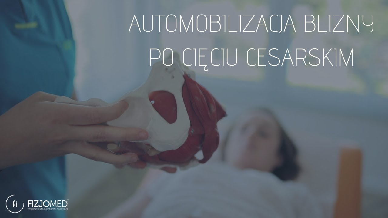 AUTOMOBILIZACJA BLIZNY PO CESARSKIM CIĘCIU