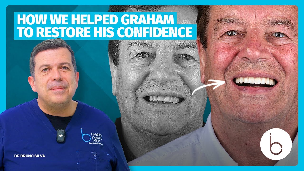 DR BRUNO SILVA: How we helped Graham to restore his confidence with ALL-ON-X solution