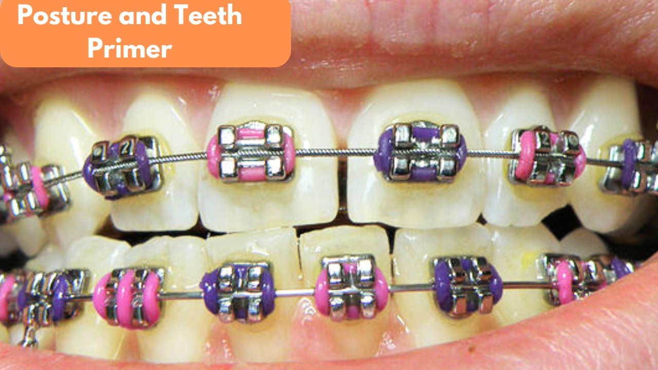 The Complete Guide to Postural Restoration and Dental Integration