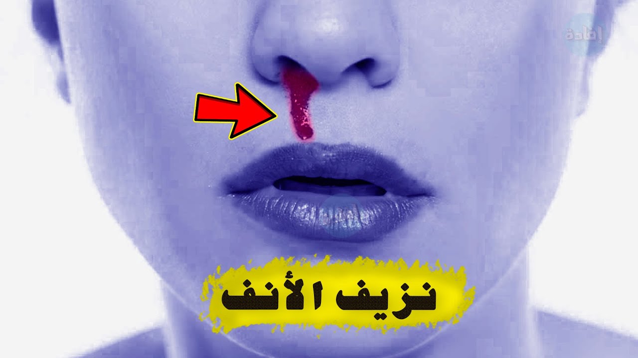 أسباب نزيف الأنف من فتحة واحدة