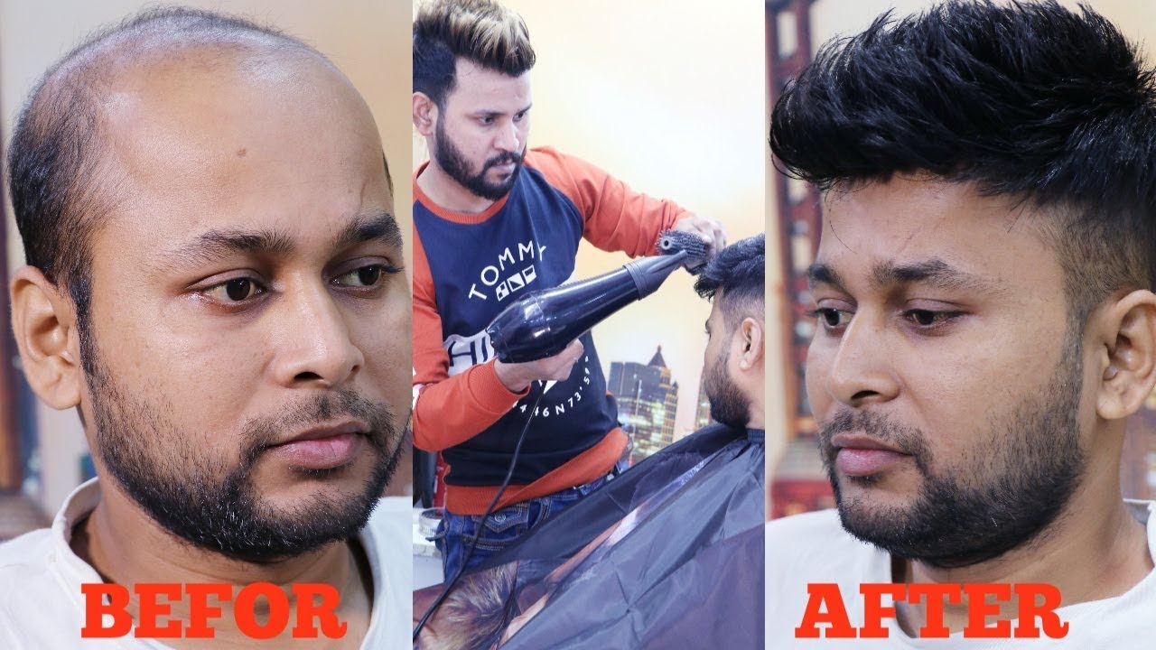 Hair Patch For Men,Hair Transformation,Solution For Hair Fall By Rizy 9582581323,9971376874