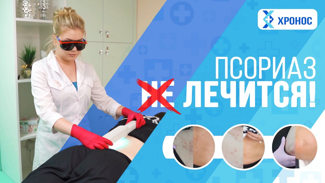 Облучатеь для лечение псориаза ультрафиолетом Ультрамиг 311Р