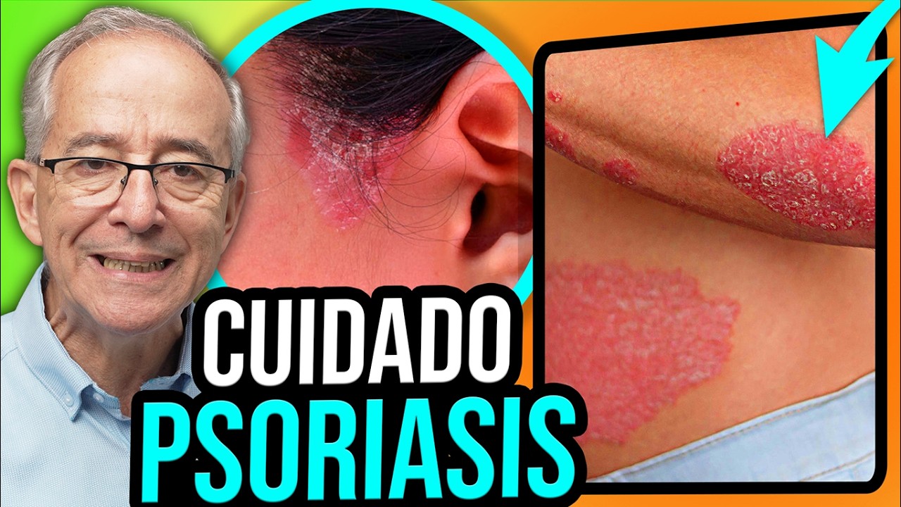 🧴 PSORIASIS Causas Y Tratamiento - Oswaldo Restrepo RSC