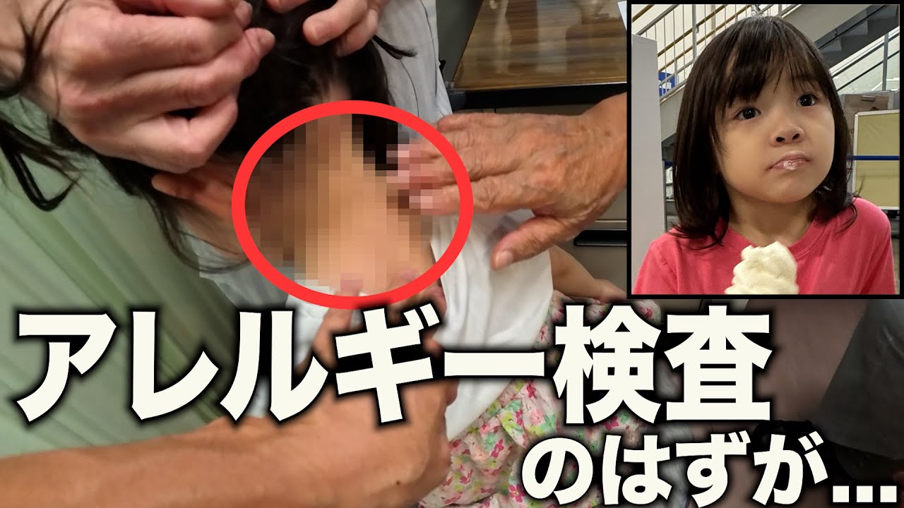 【肌荒れを無くしたい】5歳娘が病院から言われた一言。アレルギー検査を受けるつもりが...?