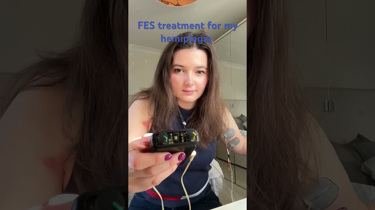Update on  functional electrical stimulation (FES) treatment for my hemiplegia  #hemiplegia #stroke