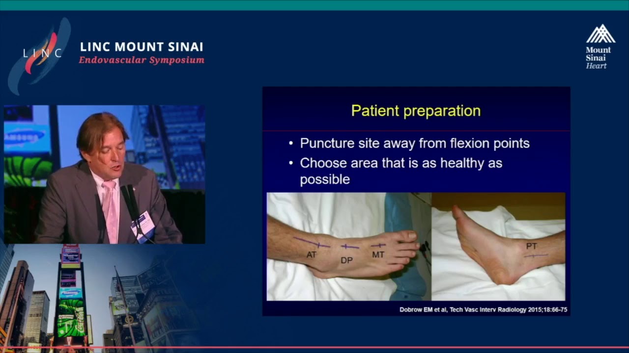 Fluoroscopic Guided Techniques for Pedal Access: Tips and Tricks