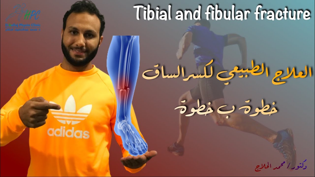 العلاج الجراحي والطبيعي والتأهيل لكسر الساق من الألف للياء للدكتور محمد الحلاج dr Mohamed Elhallaj