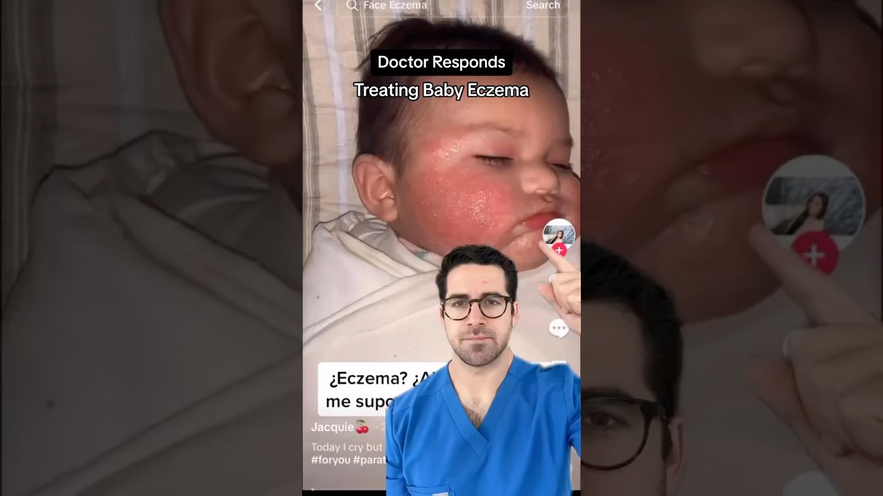 How To Treat Baby Eczema 👶 | Dr. Yoshi&rsquo;s Tips for Soothing Dry, Itchy Skin