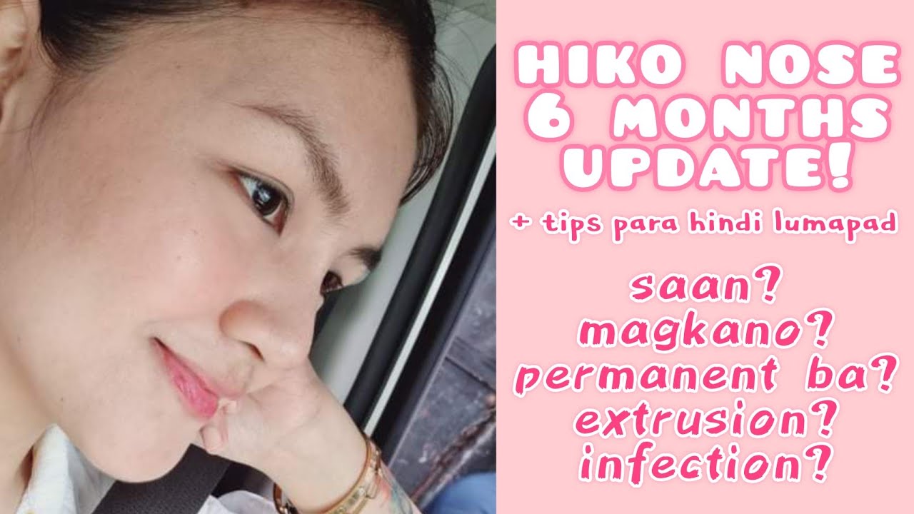 HIKO NOSE 6 MONTHS UPDATE | FAQs ANSWERED + TIPS PARA HINDI LUMAPAD ANG ILONG DAHIL SA THREADS