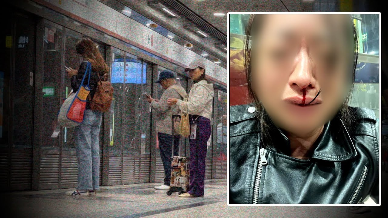 東張西望｜搭港鐵遇無妄之災 被襲擊致流血不止 事主盼將傷人者繩之於法｜港鐵｜被襲擊｜荃灣西｜黎寬怡