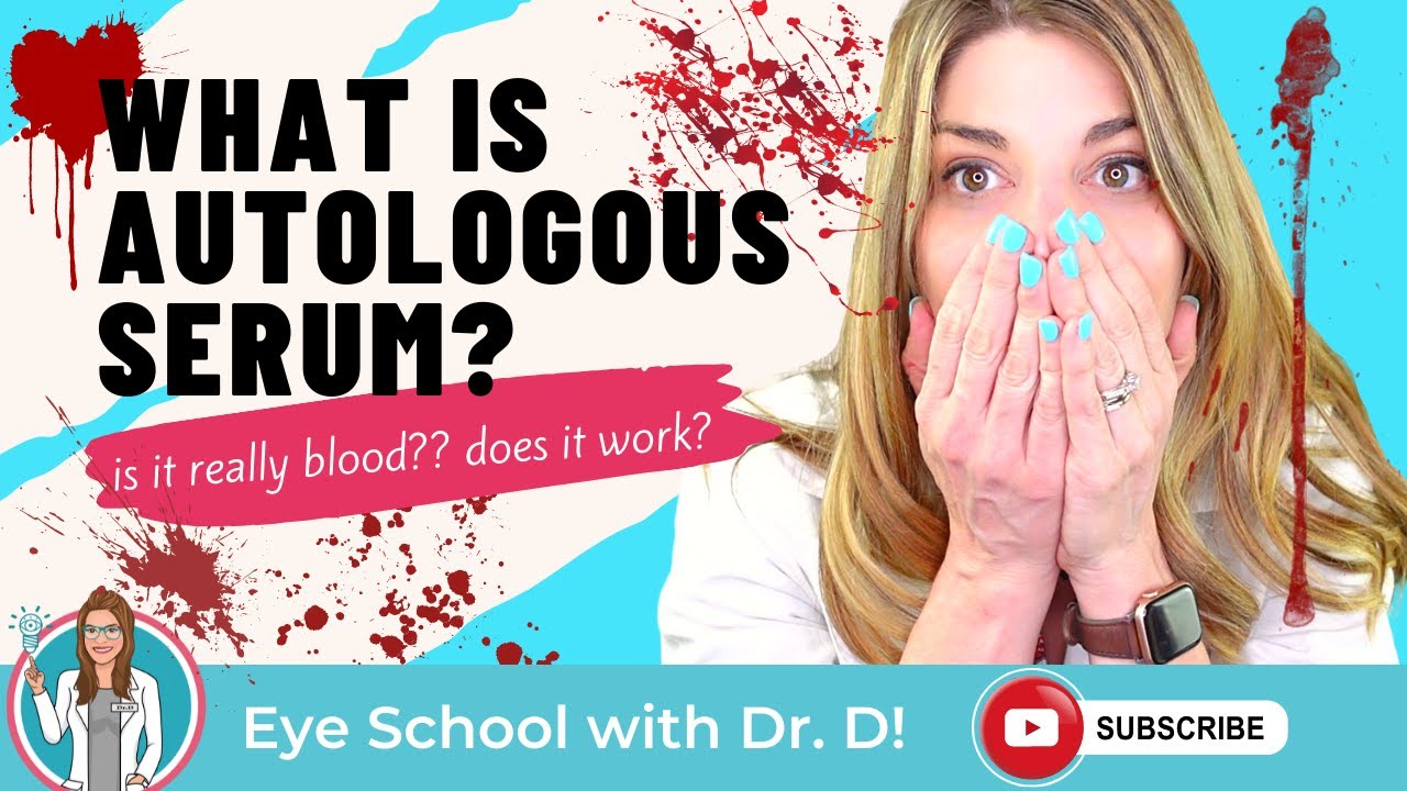 Do Autologous Serum Eye Drops Work? What Is Autologous Serum? | An Eye Doctor Explains