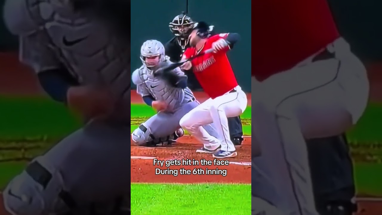Guardians DH David Fry broke his nose after taking 99-mph fastball to face from Tigers ace Skubal