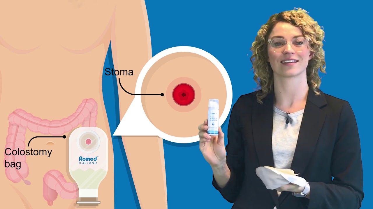 Romed Medical Adhesive Remover